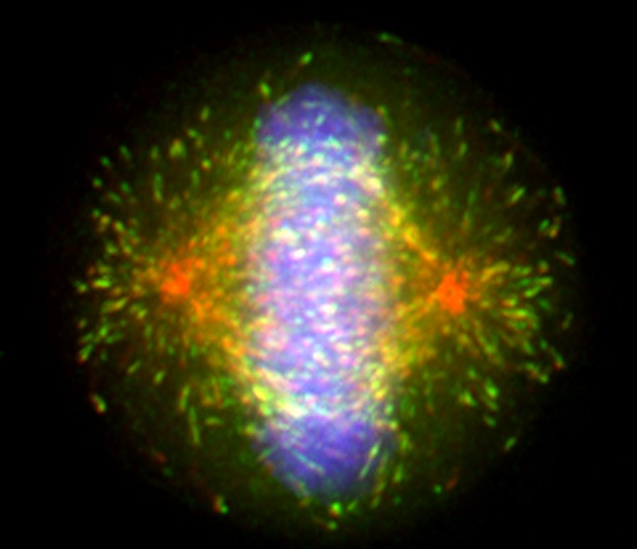 Stumpff Lab | Kinesins, Cell Division & Cancer | University of Vermont