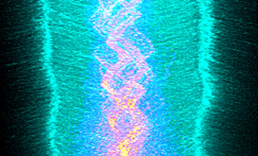 Kymograph of a metaphase spindle: cyan microtubule tracks on either side of a braided pink and yellow band of kinetochore paths