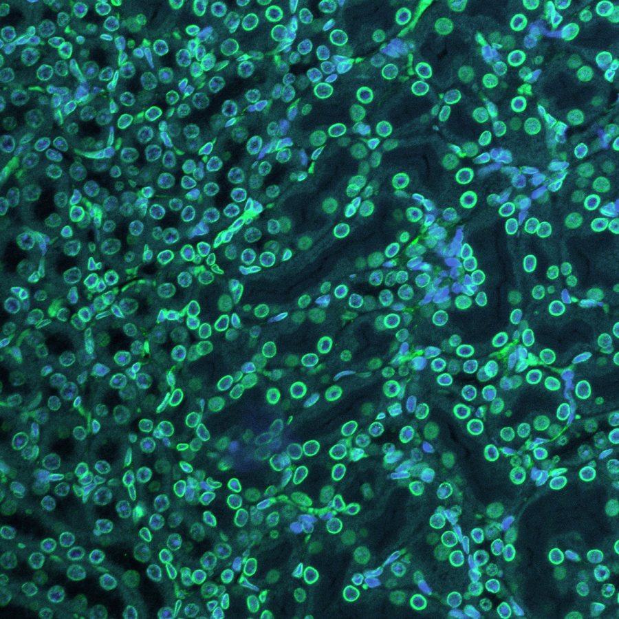 Dense field of mouse liver cells with green nuclear rims and blue nuclei