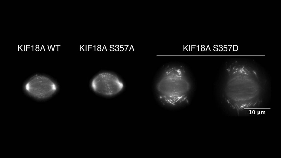 Grayscale spindles labeled KIF18A WT, KIF18A S357A, and KIF18A S357D
