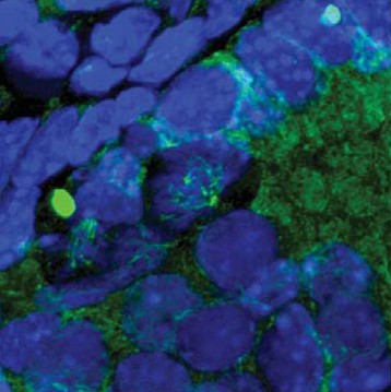 Testis section from a Kif18a mutant mouse, DNA in blue and alpha-tubulin in green
